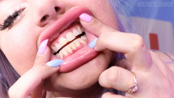 Mistress Bijoux – Teeth up Close